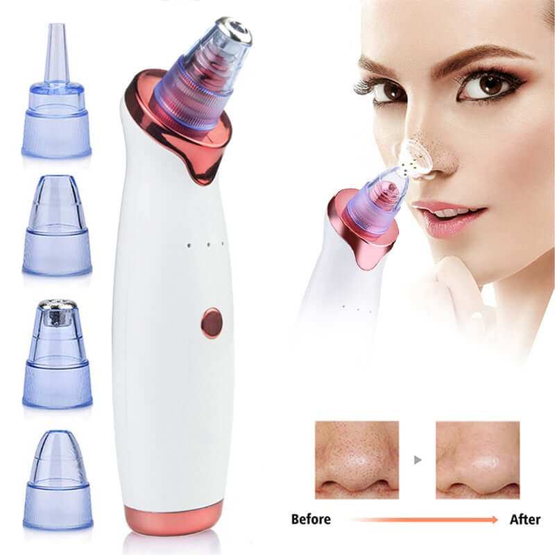 Electric vacuum facial blackhead remover with suction heads, demonstrating blackhead removal and skin smoothness results.